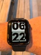 Carbon Fiber Gear CarboShield Forged Carbon Fiber Case for 44mm Apple Watch Series 6 / SE / 5 / 4 Review