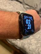 Carbon Fiber Gear CarboShield Forged Carbon Fiber Case for 44mm Apple Watch Series 6 / SE / 5 / 4 Review